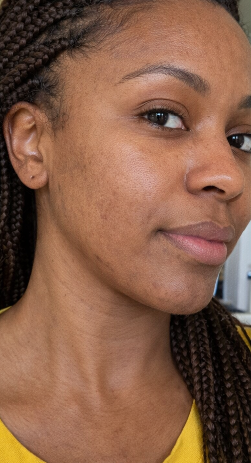 Before - Chantelle, 29